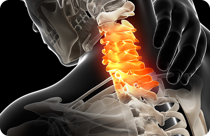 척추 질환 이미지1