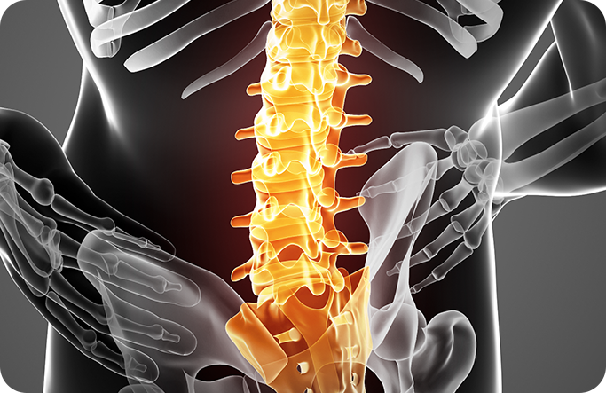 척추 질환 이미지2