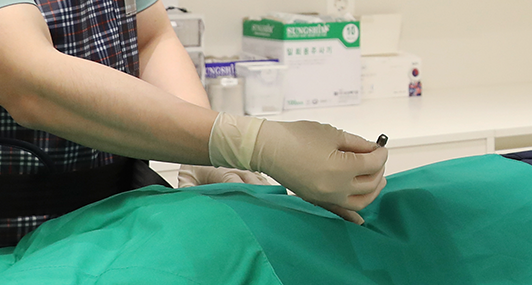 신경차단술 사진