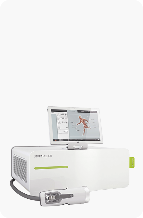 방사형 체외충격파 장비